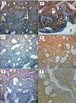 VEGF Antibody in Immunohistochemistry (IHC)