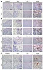 Claudin 5 Antibody in Immunohistochemistry (IHC)