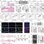 RAB27A Antibody in Western Blot, Immunohistochemistry (WB, IHC)