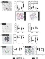 WT1 Antibody in Immunohistochemistry (IHC)