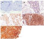 GDF11 Antibody in Immunohistochemistry (IHC)