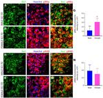 Phospho-IKK alpha (Ser176, Ser180) Antibody in Immunohistochemistry (IHC)