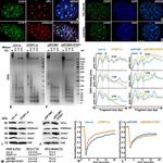 CFDP1 Antibody in ChIP Assay (ChIP)