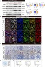 TRPA1 Antibody in Western Blot (WB)