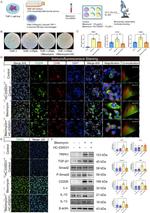 TRPA1 Antibody in Western Blot (WB)