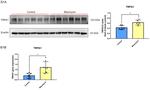 TRPA1 Antibody in Western Blot (WB)