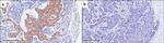 SLC35A2 Antibody in Immunohistochemistry (IHC)