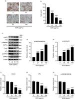 LPL Antibody in Western Blot (WB)