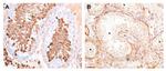 HSPA2 Antibody in Immunohistochemistry (IHC)