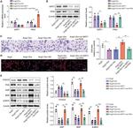 FOXO3A Antibody in Western Blot (WB)