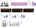 ANP Antibody in Western Blot (WB)