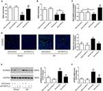 ACMSD Antibody in Western Blot (WB)