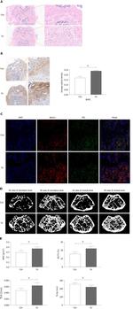 BMP-2 Antibody in Immunohistochemistry (IHC)