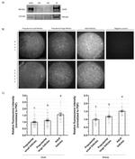 EGFR Antibody in Western Blot (WB)