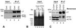 ETS1 Antibody in Western Blot, Immunoprecipitation (WB, IP)