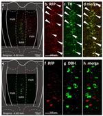 Dopamine beta Hydroxylase Antibody in Immunohistochemistry (IHC)
