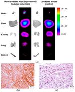 FAP Antibody in Immunohistochemistry (IHC)