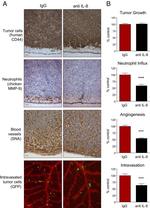 IL-8 (CXCL8) Antibody in Neutralization (Neu)