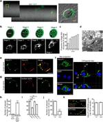 NTF3 Antibody in Neutralization (Neu)