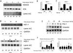 PAI1 Antibody in Western Blot (WB)