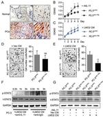 IL-11 Antibody in Neutralization (Neu)
