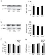 HPV Type 16 E7 Antibody in Western Blot (WB)