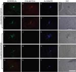 Borrelia burgdorferi Antibody in Immunohistochemistry (IHC)