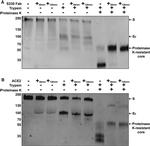 SARS Coronavirus Spike Protein Antibody in Western Blot (WB)