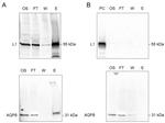 HPV Type 16 L1 Antibody in Western Blot (WB)