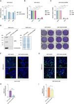 SARS Coronavirus Spike Protein Antibody in Western Blot (WB)