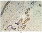 SARS-CoV-2 Spike Protein S1 Antibody in Immunohistochemistry (IHC)