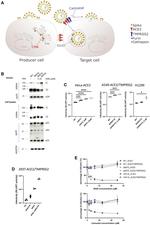 SARS Coronavirus Spike Protein Antibody in Western Blot (WB)