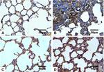 TGF beta-1 Antibody in Immunohistochemistry (IHC)
