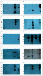 Porcine Circovirus Type 2 Capsid Antibody in Western Blot (WB)