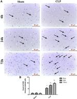 CD8 alpha Antibody in Immunohistochemistry (IHC)