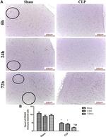 CD8 alpha Antibody in Immunohistochemistry (IHC)