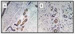 SARS-CoV-2 Spike Protein S1 Antibody in Immunohistochemistry (IHC)