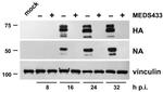 Influenza A H1N1 NA Antibody in Western Blot (WB)