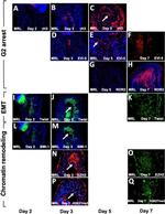 EZH2 Antibody in Immunohistochemistry (IHC)