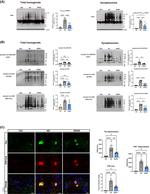 Phospho-Tau (Ser396) Antibody in Western Blot (WB)
