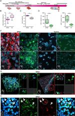 Streptococcus pneumoniae Polyclonal Antibody