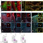 GFAP Antibody in Immunohistochemistry (PFA fixed) (IHC (PFA))