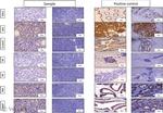 PSAP Antibody in Immunohistochemistry (IHC)