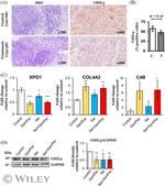 CHIL3 Antibody in Western Blot, Immunohistochemistry (WB, IHC)