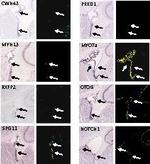 NOTCH1 Antibody in Immunohistochemistry (IHC)