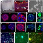 CD56 (NCAM) Antibody in Immunohistochemistry (IHC)