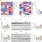 ANGPTL4 Antibody in Western Blot (WB)