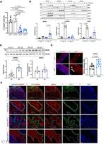 GRP78 Antibody in Western Blot (WB)