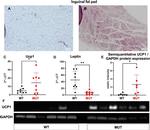 UCP1 Antibody in Western Blot (WB)