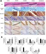 Bcl-2 Antibody in Immunohistochemistry (IHC)